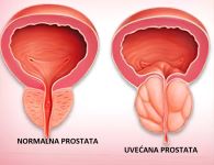 Oboljenja  Saznajte sve o simptomima, dijagnozi i leenju | Millenium  Medic - Slavija, Vraar, Beograd